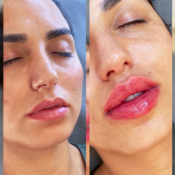 Виктория Врублевская, Вінниця Фото - 26