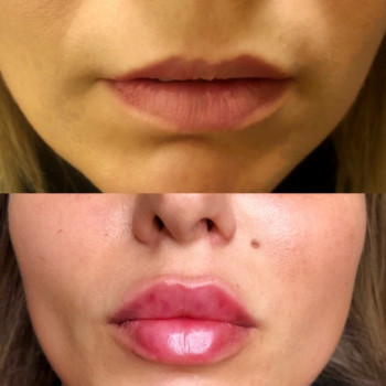 Виктория Врублевская, Вінниця Фото - 27