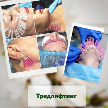 Катерина Колос, Київ Фото - 13