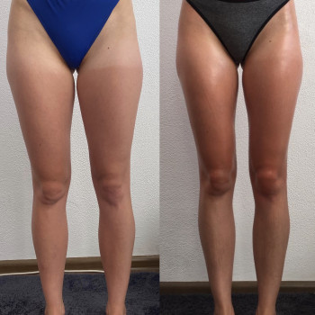 Тина , Киев Фото - 4