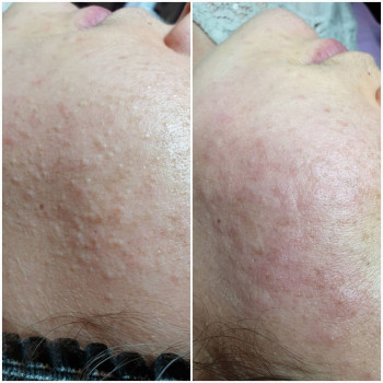 Альона Науменко, Бориспіль Фото - 10