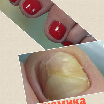 Евгения Решетник, Одесса Фото - 60