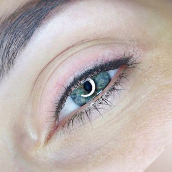 Межресничная стрелка