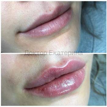 Катерина Колос, Київ Фото - 32