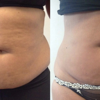 Дарья Полковникова , Мелітополь Фото - 9