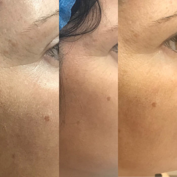 Дарья Полковникова , Мелітополь Фото - 11