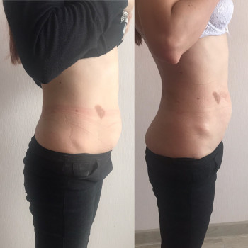 Дарья Полковникова , Мелітополь Фото - 20