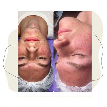 Татьяна Беренок , Фастів Фото - 5