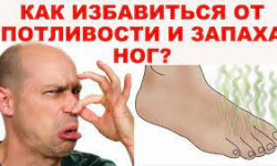 Потливость ног лечение Косметолог-ін'єкціоніст Елена Харків