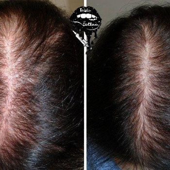 Таисия Баткова, Харків Фото - 22