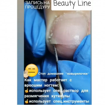 Педикюр апаратний
                    Салон краси Beauty Line Запоріжжя