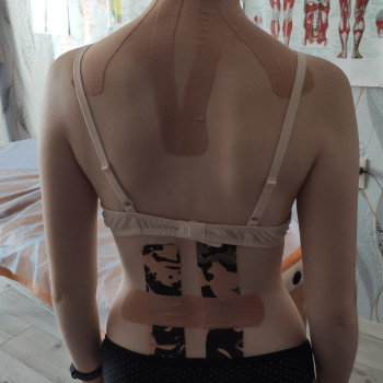 Кінезіотейпування
                    Реабілітолог Алина Суми