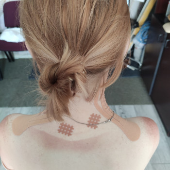 Кінезіотейпування
                    Реабілітолог Алина Суми