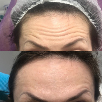 Вадим Васьковський, Житомир Фото - 2