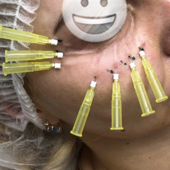 Вадим Васьковський, Житомир Фото - 4