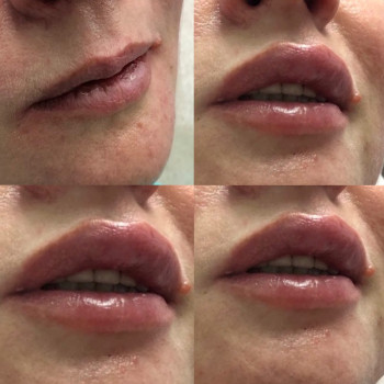 Вадим Васьковський, Житомир Фото - 7