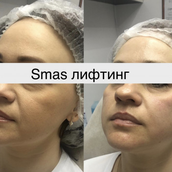 Вадим Васьковський, Житомир Фото - 8