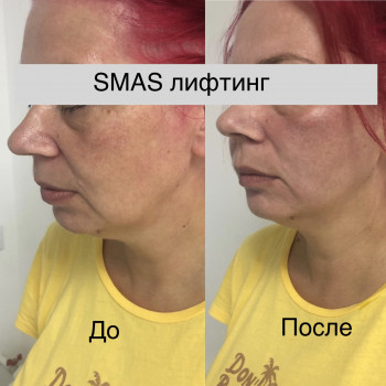 Вадим Васьковський, Житомир Фото - 13