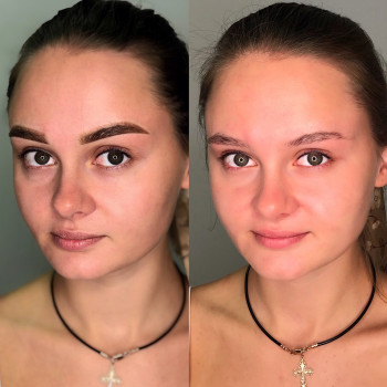 Антонина Курилюк, Чернівці Фото - 14