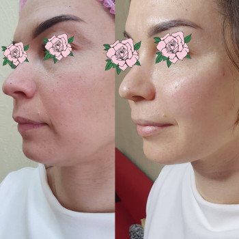 Елена Журба, Кропивницкий Фото - 1