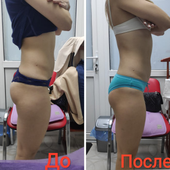 Kryshtal beauty, Вишневе Фото - 2