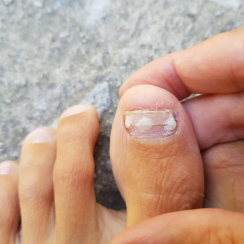 Татьяна Адаменко, Бровары Фото - 12