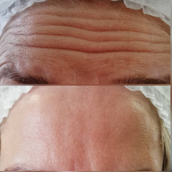 Softex, Бровары Фото - 18