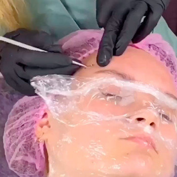 Механическая чистка