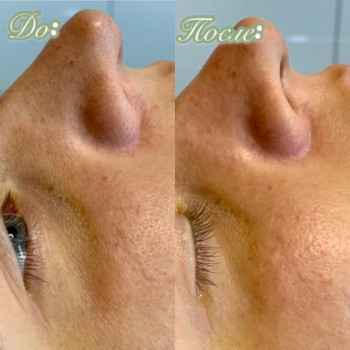 Мужская чистка