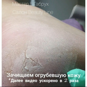 Педикюр апаратний
                    Салон краси Beauty Line Запоріжжя