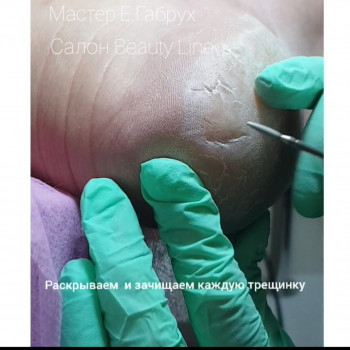 Педикюр апаратний
                    Салон краси Beauty Line Запоріжжя