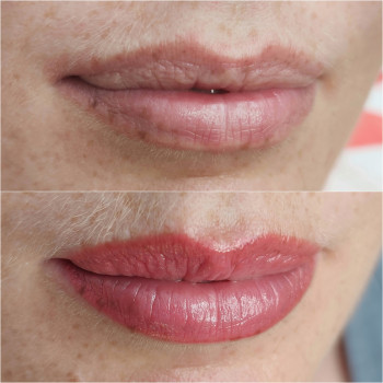 Заживший ПМ губ, акварель