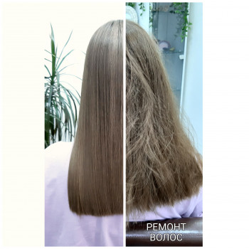 Биксипластия