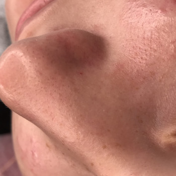 Екатерина Коновал , Кривий Ріг Фото - 5