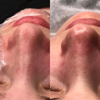 Екатерина Коновал , Кривий Ріг Фото - 7