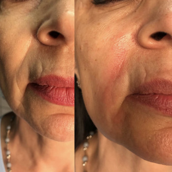 Екатерина Коновал , Кривий Ріг Фото - 10