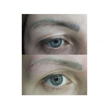 Верхнє фото до видалення, нижнє - відразу після