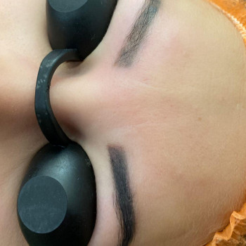 Хотите удалить надоедливое тату или перманент, который смот