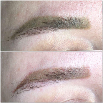 Хотите удалить надоедливое тату или перманент, который смот