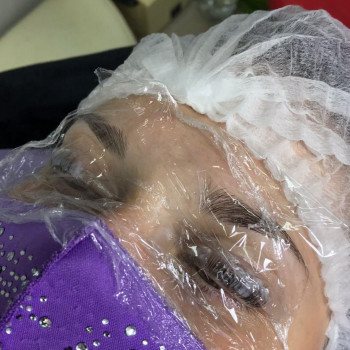 Зробити ботокс вій салон краси Бровари.