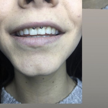 Пирсинг
                    Майстер з пірсингу Анна Чорноморськ