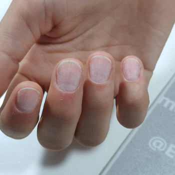 Подготовка к укреплению натур.ногтей