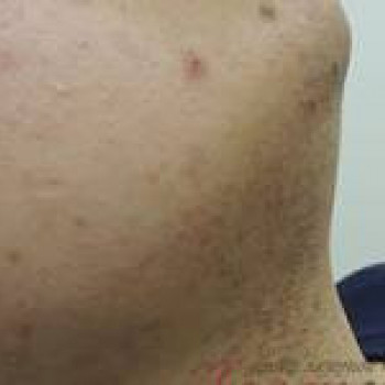 Лазерхауз, Бердянськ Фото - 10