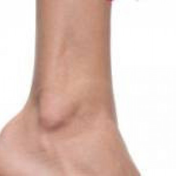 Лазерхауз, Бердянськ Фото - 13