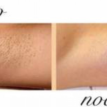 Лазерхауз, Бердянськ Фото - 1