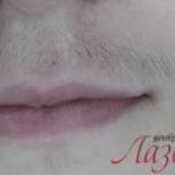 Лазерхауз, Бердянськ Фото - 14