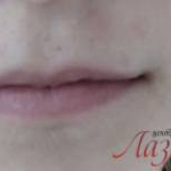 Лазерхауз, Бердянськ Фото - 15