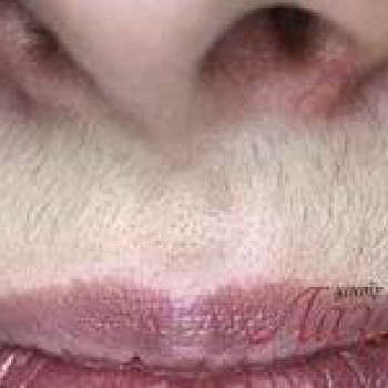 Лазерхауз, Бердянськ Фото - 16