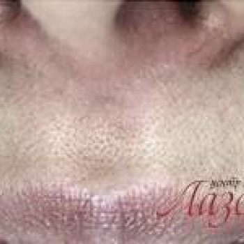 Лазерхауз, Бердянськ Фото - 17