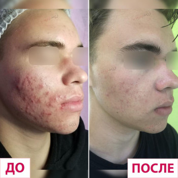 Лазерхауз, Бердянськ Фото - 19